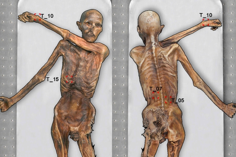 Új tetoválásokat fedeztek fel Ötzi, a gleccsermúmia bőrén