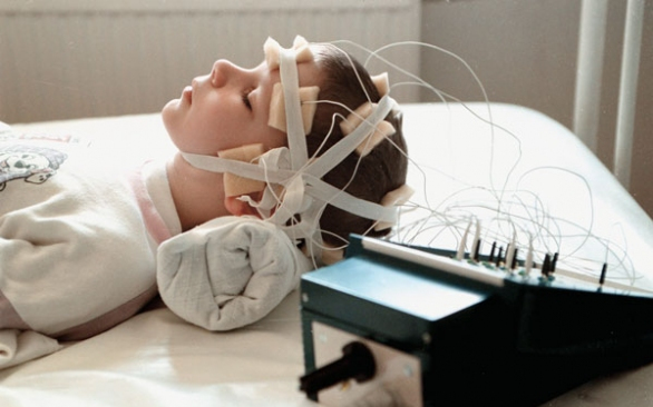 Segítség az epilepsziásoknak