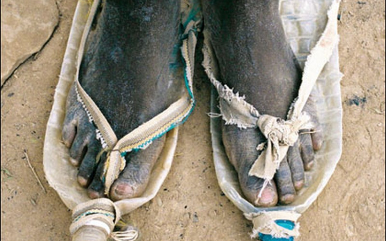 Fájdalmas lépések