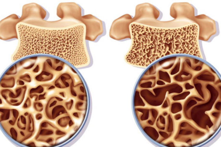 Te is érintett vagy? 