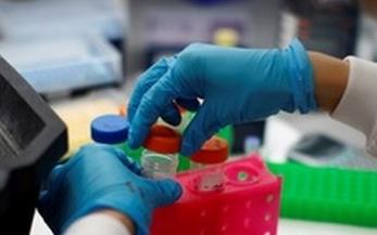 Tumorbankot alakítanak ki Szegeden