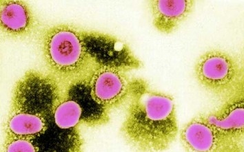 Újabb megbetegedés Franciaországban a tavaly felfedezett koronavírustól