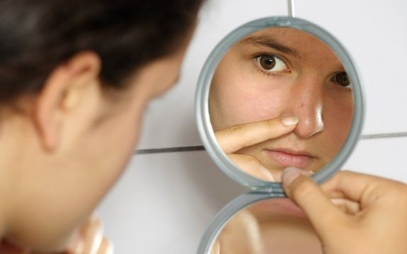 Pattanásos vagy? Nem mindegy, hol van a pattanás! 