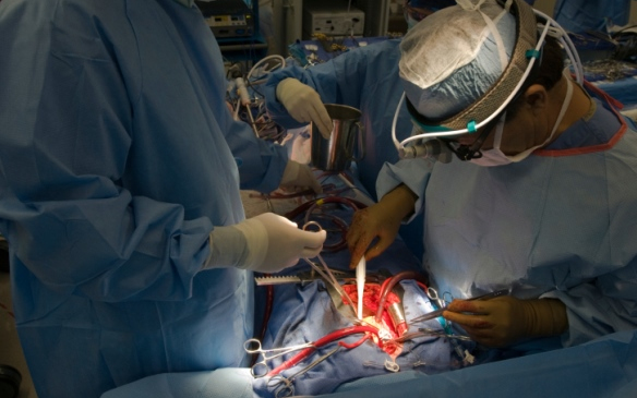 Mely szerveinket cserélhetjük ki? Nézze meg!